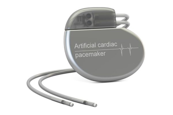 How Does a Pacemaker Work? | My Rhythm Device